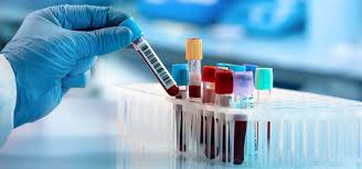 Specialty Diagnostic Panels — Shree Pathology Laboratory